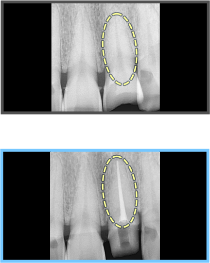 심미보철 증례01