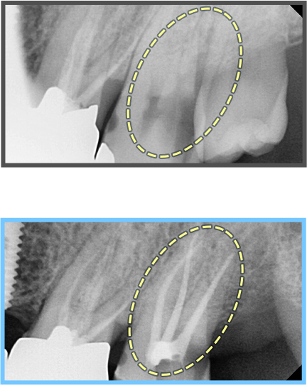 심미보철 증례02