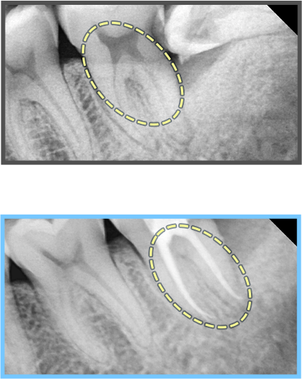 심미보철 증례04