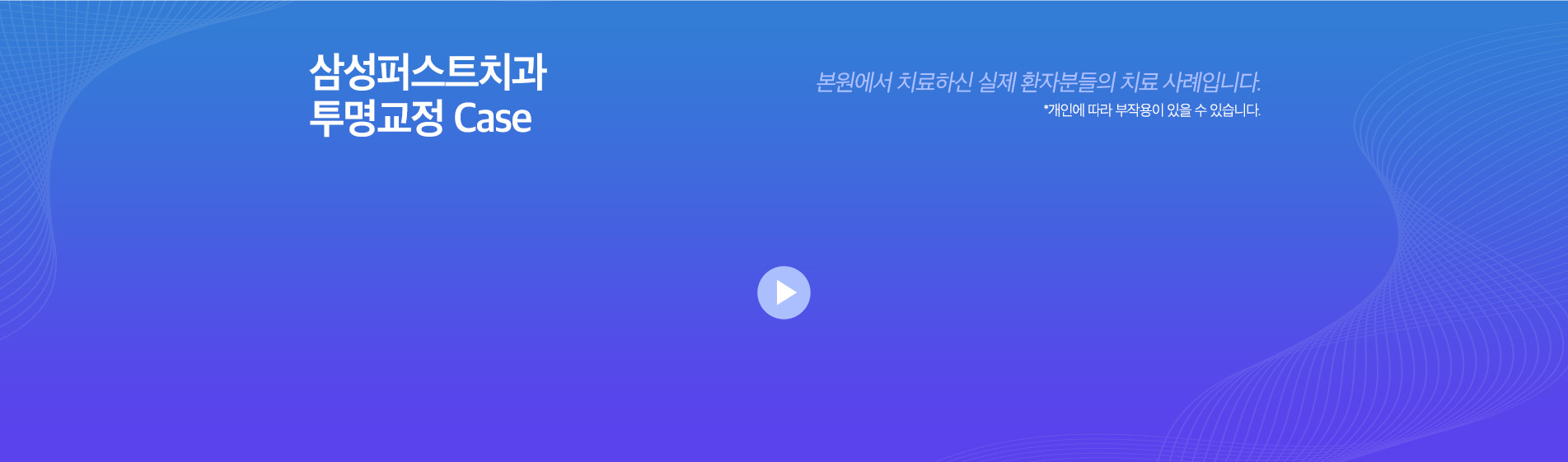 투명교정